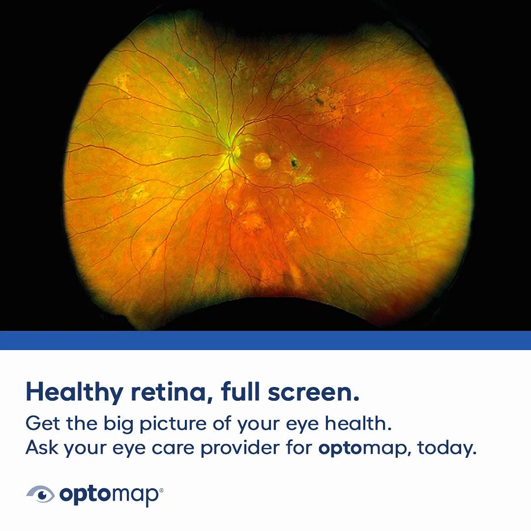 OPTOMAP Retinal Imaging